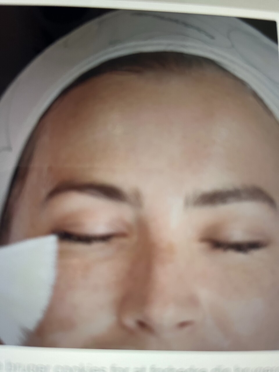 Hudpleje